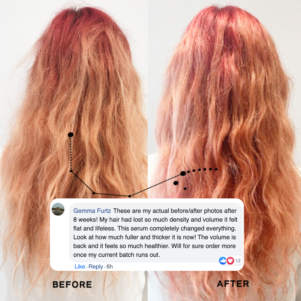 Aceite para el crecimiento del cabello contra la caída del cabello