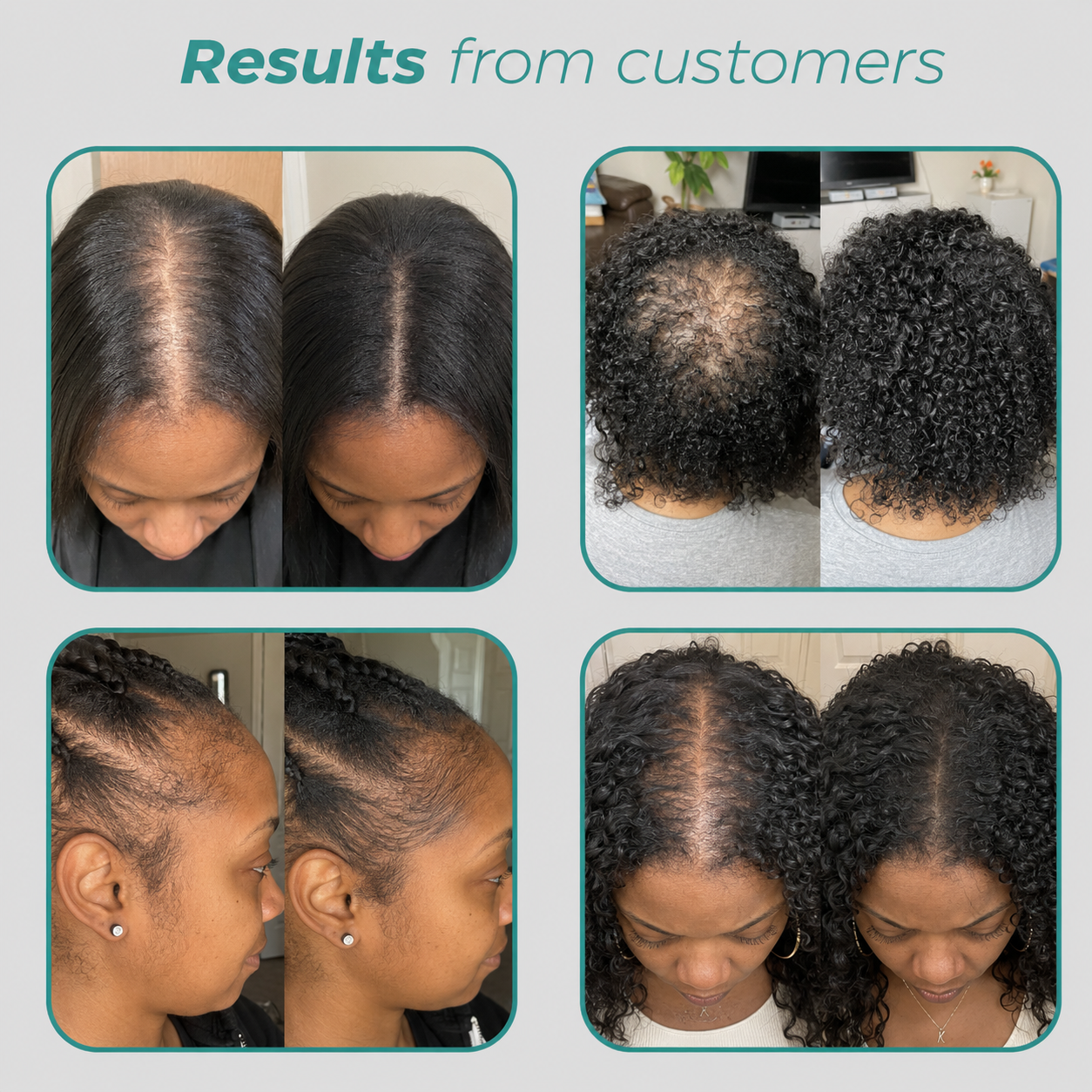 Gomitas Hair Revive